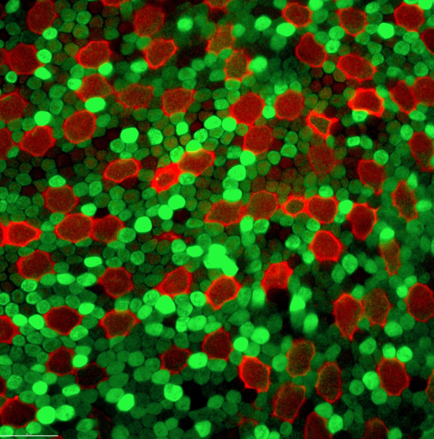 Fluorescently labelled cone photoreceptors