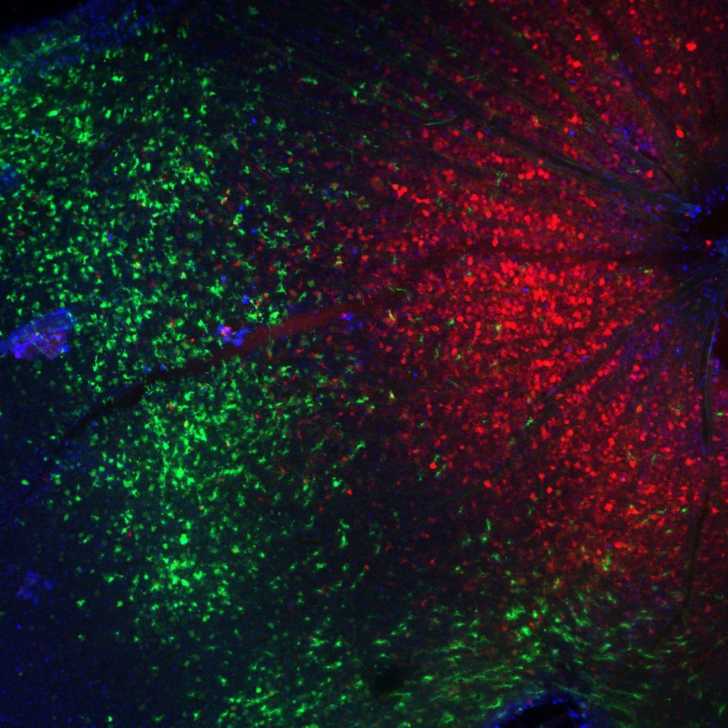 Dual AAV injection showing eGFP and mCherry expression with DAPI