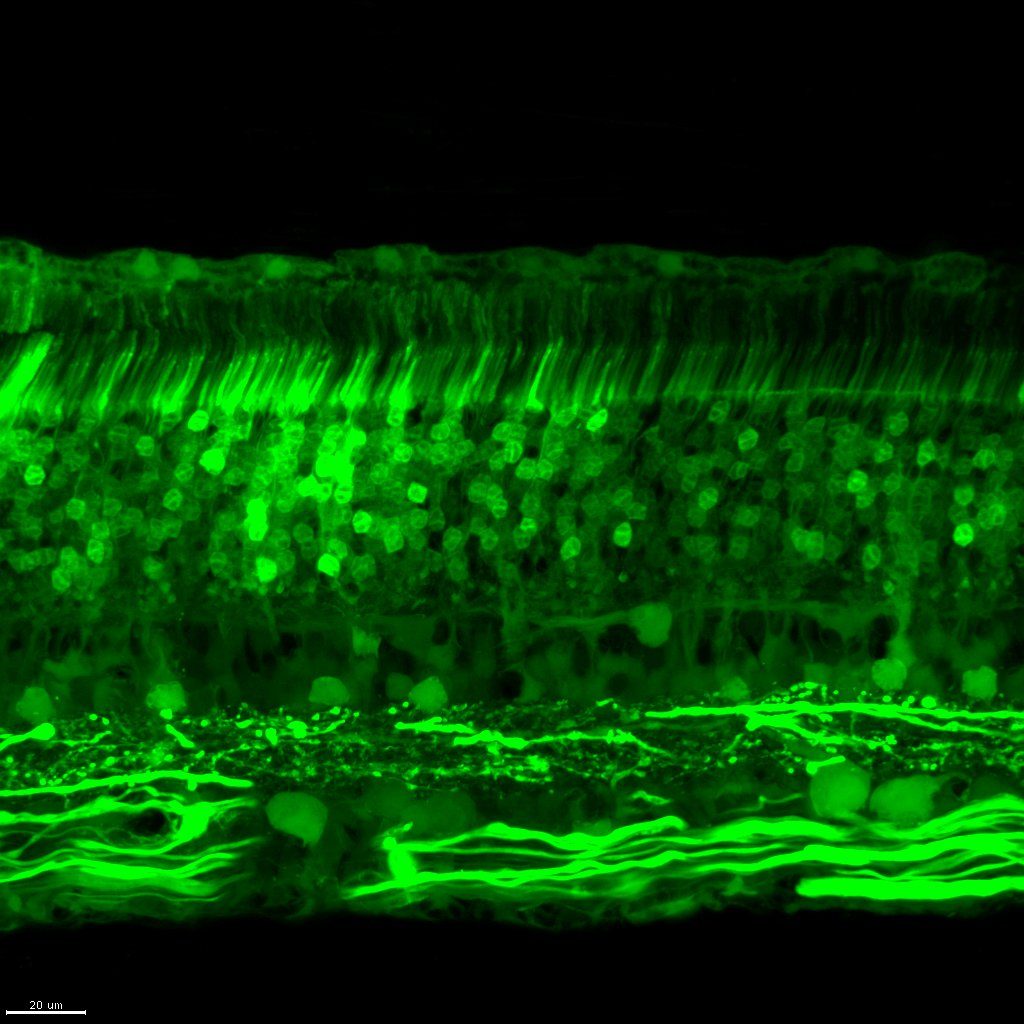 AAV library screening in a large-animal retina