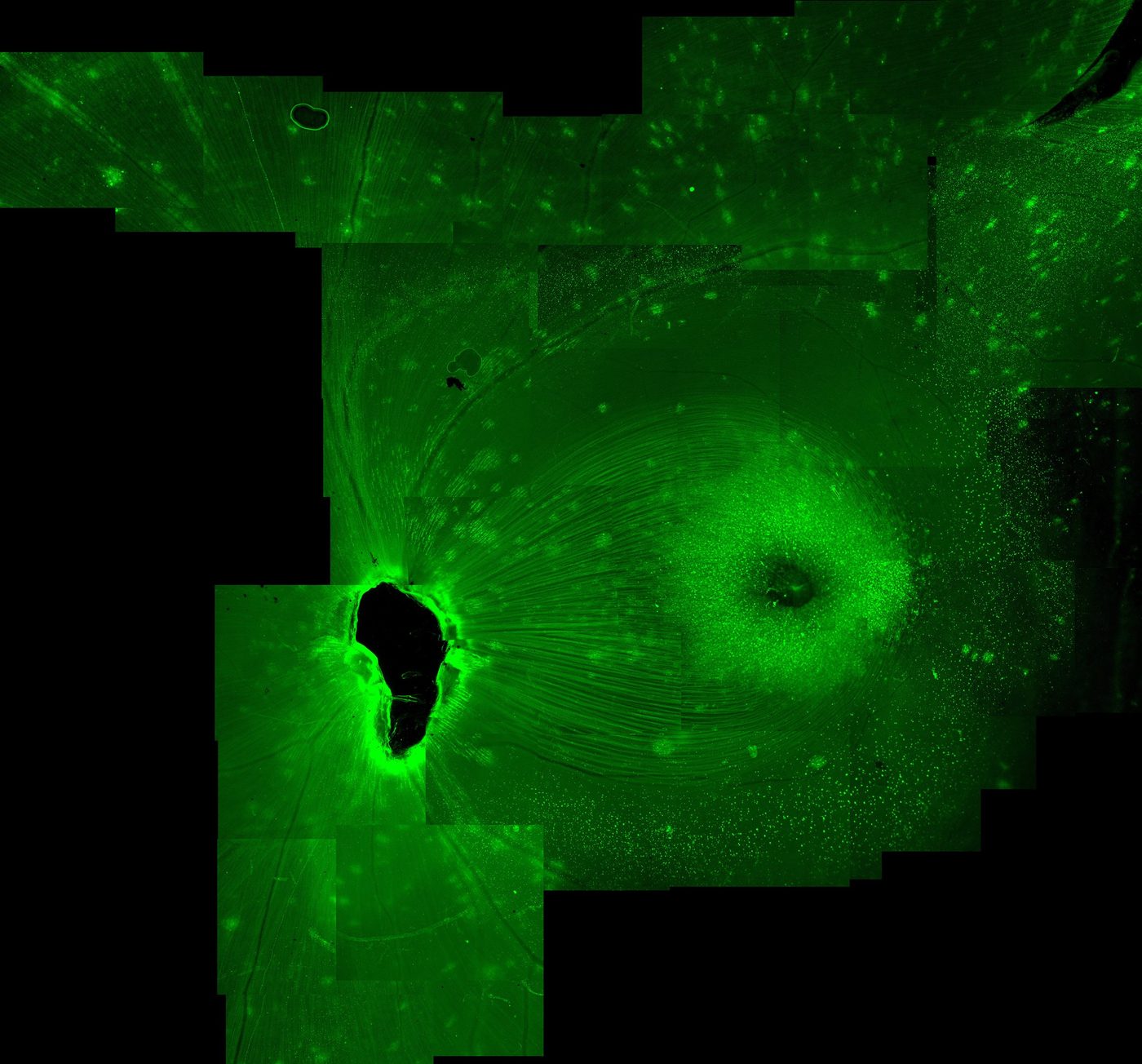 Montage of retinal imaging data