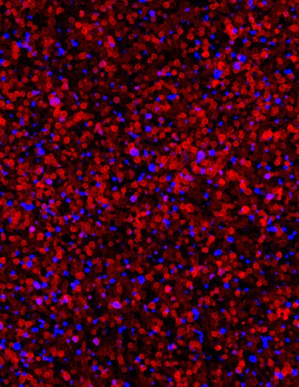 Wide-field mosaic of a transduced retina