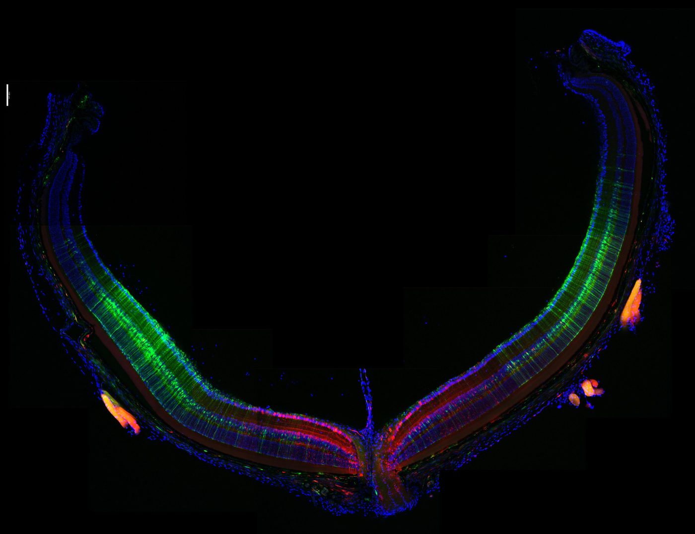 Flat-mounted mouse retina with fluorescent transgene expression