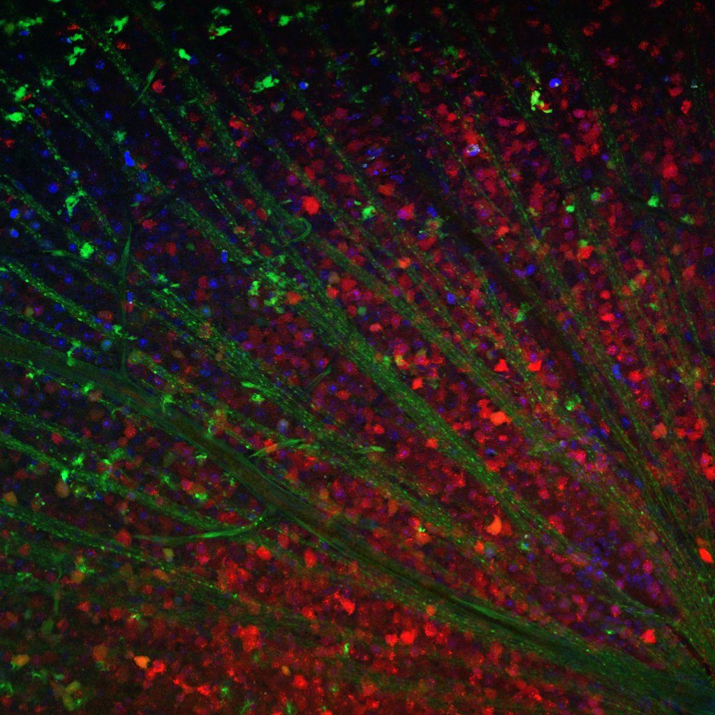 Mouse retina expressing a fluorescent reporter