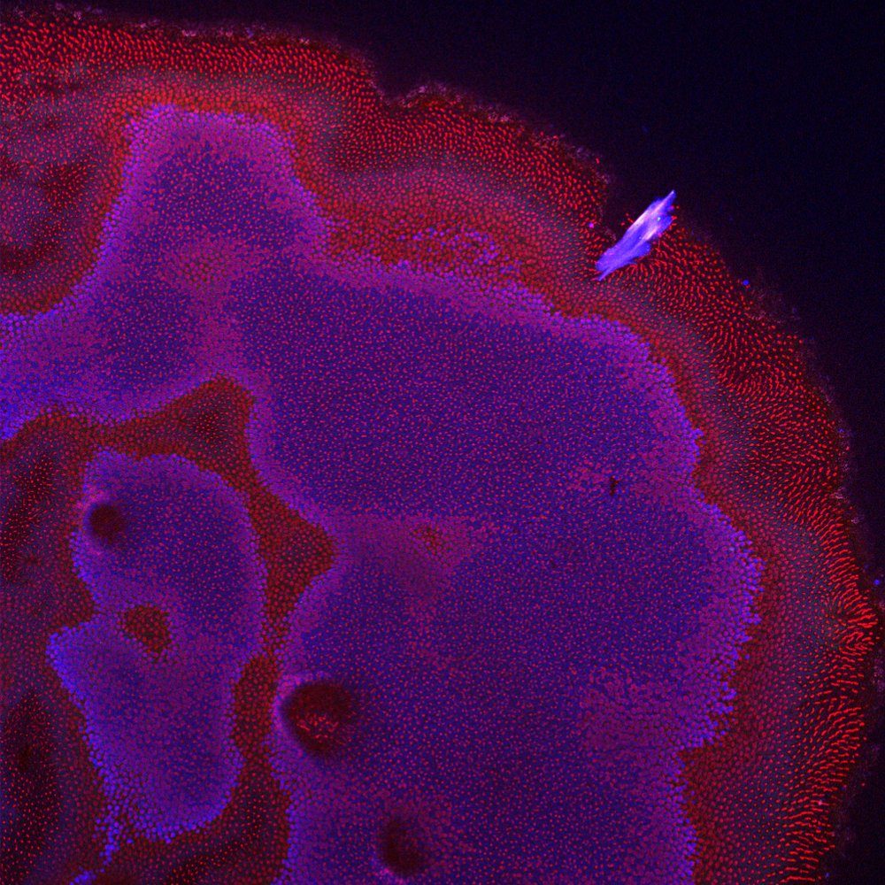 Retinal cross-section stained with DAPI, CAR594 and PKC-alpha