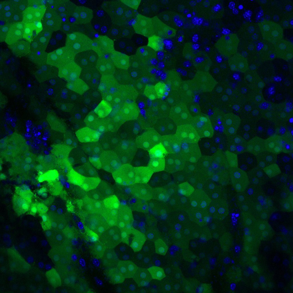 Retinal pigment epithelium cells in culture