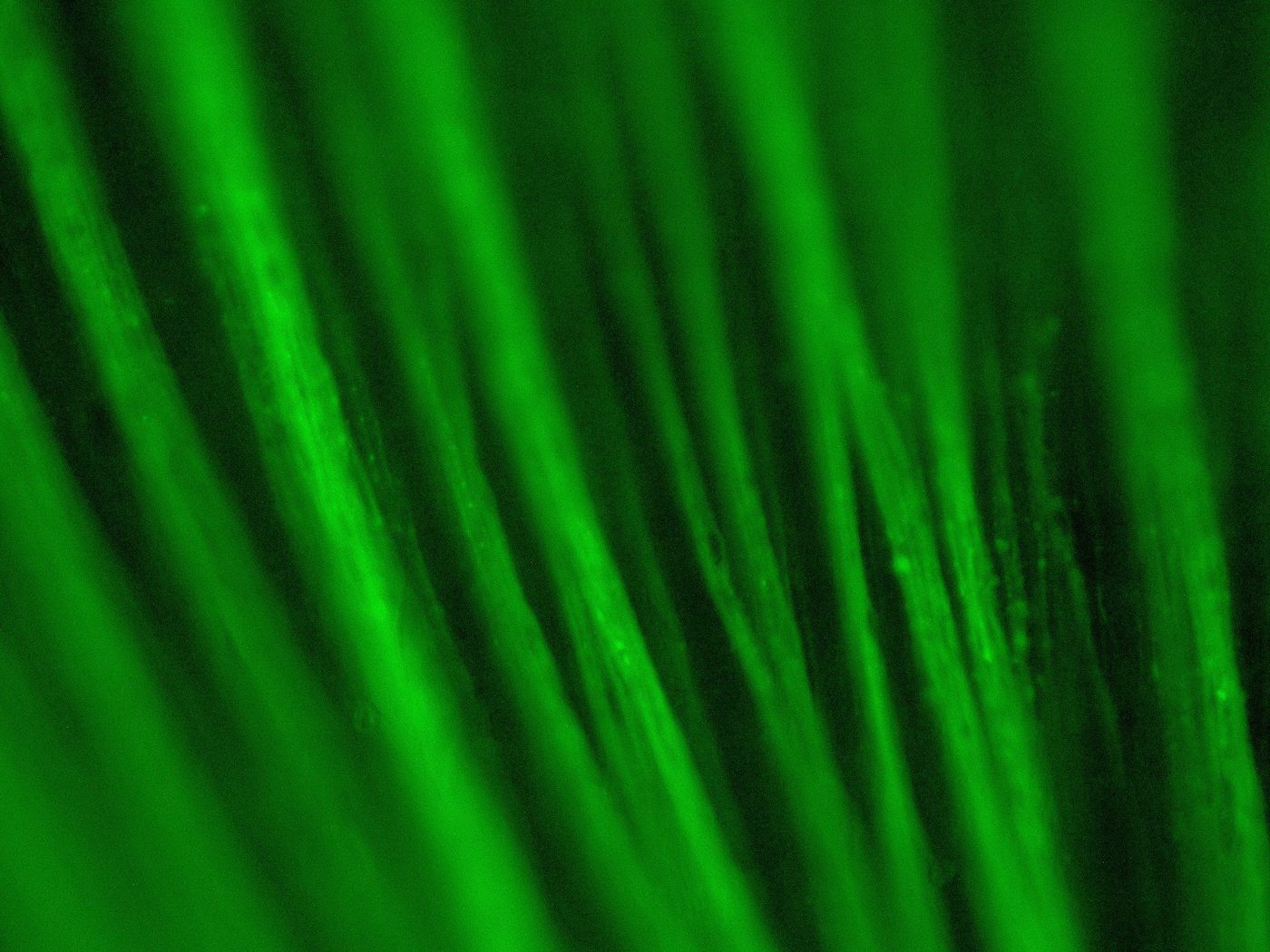 Supplementary figure showing retinal transduction data